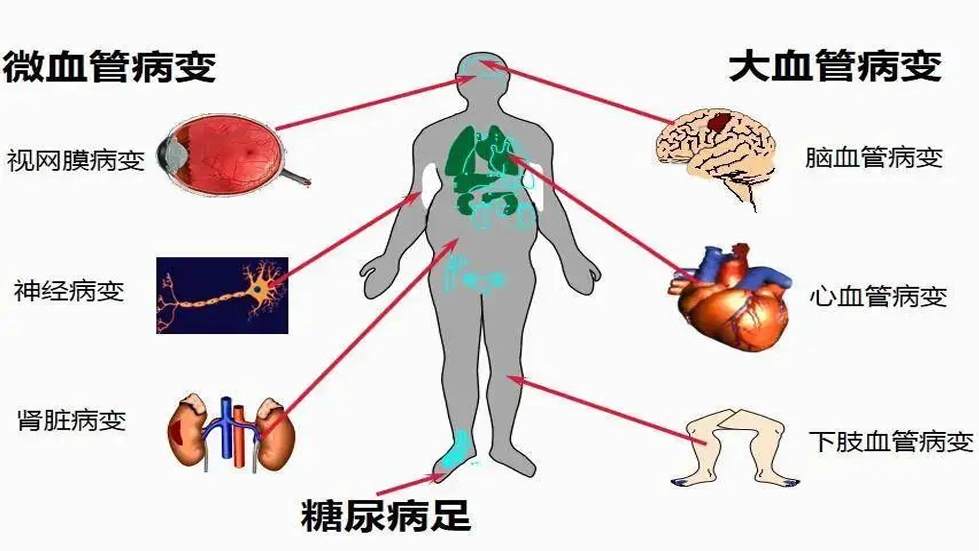 【醫(yī)院動(dòng)態(tài)】聯(lián)合國糖尿病日|糖尿病與幸福感