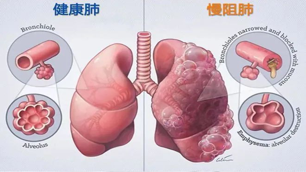 【醫(yī)院動態(tài)】了解你的肺功能